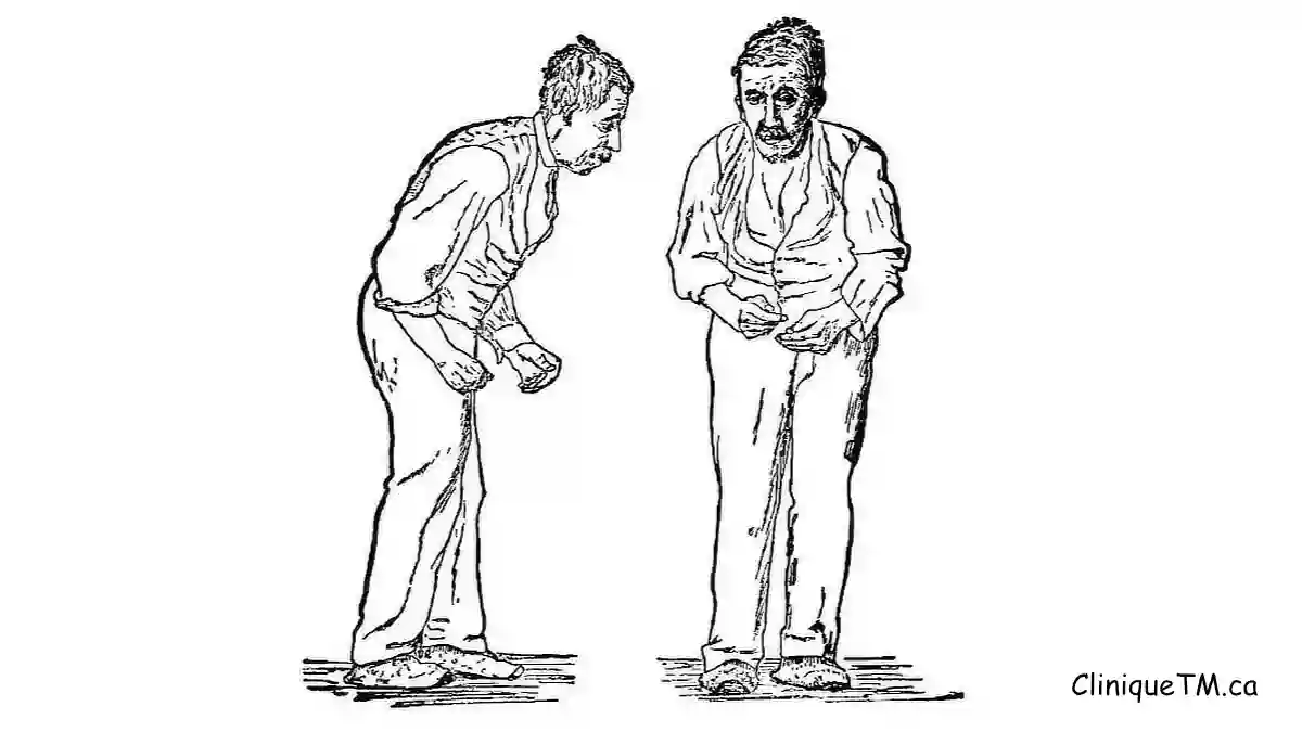 Alternative treatment for Parkinson's disease