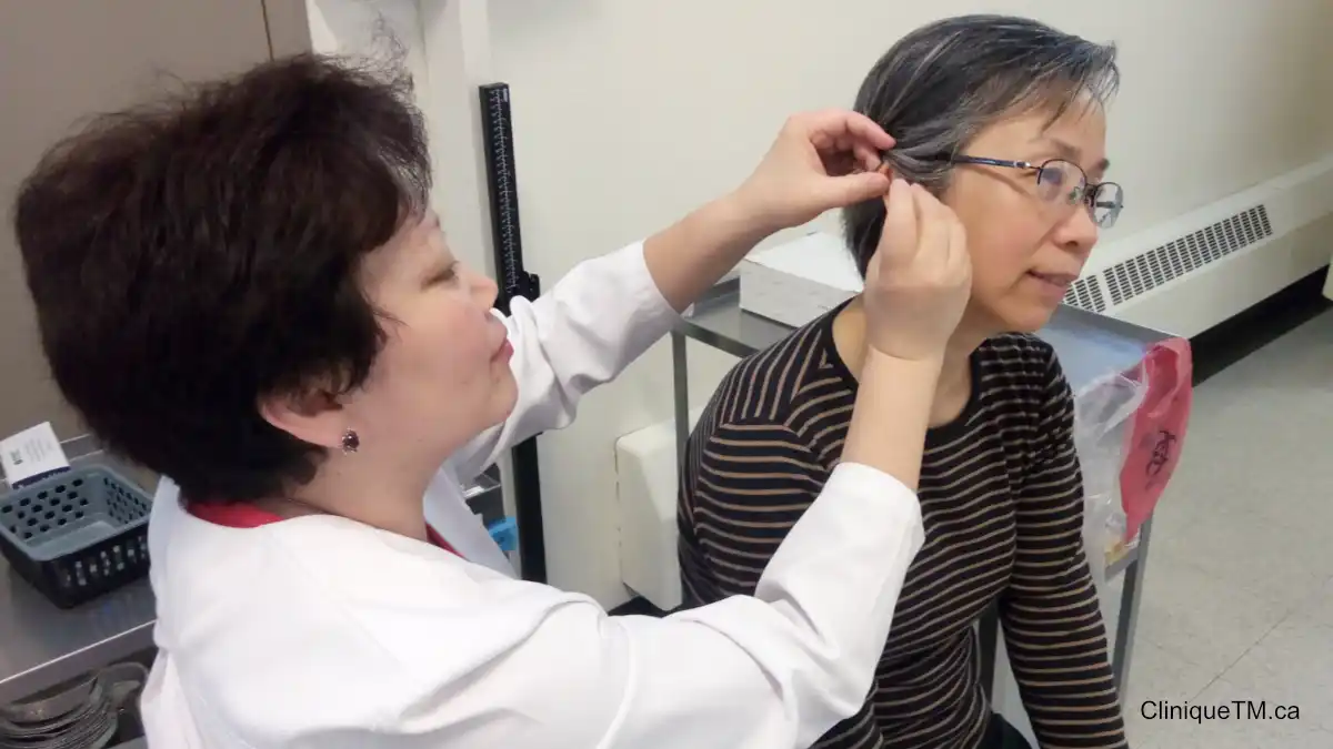 Acupuncturist Alexandra Deyneko, Ac
