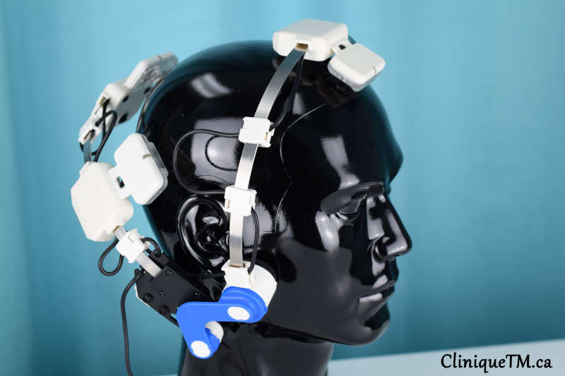 alternative treatment for parkinson's disease transcranial photobiomodulation