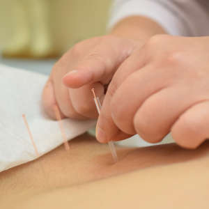 Clinic of acupuncture Longueuil