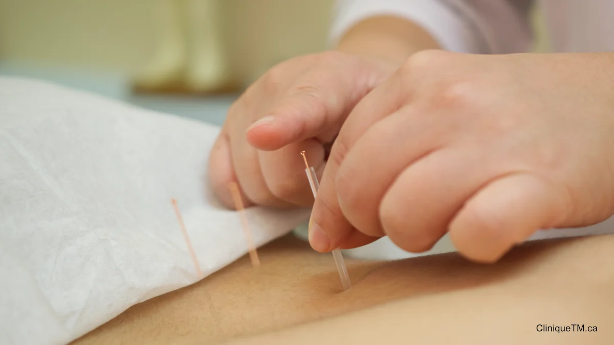 Acupuncture traditionnelle Clinique Traditions et Modernité Inc.