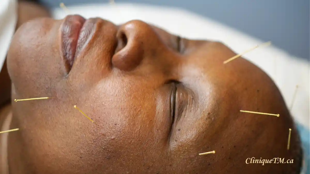 acupuncture Clinique Traditions et Modernité Inc.
